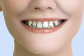 如果你的牙齿稀疏，矫正是这样的！视频封面