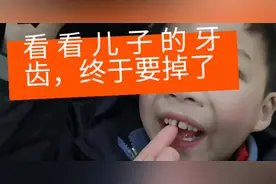 孩子的乳牙要掉了，是去医院拔还是传统方法自己拔下来呢！