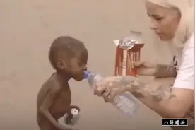 当年皮包骨的非洲小男孩讨水喝，现在怎么样了？看完你会感到欣慰