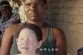 世上最“值钱”的人？血液堪比黄金玛瑙，日常出行有专业特警保护视频封面