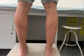 腰部又痛又麻，还很僵硬？医生点出：是腿的问题视频封面