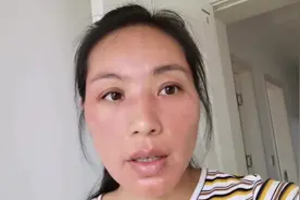 小容用一次性面膜过敏，脸又红又痒，求大家给答案让我快点好起来视频封面