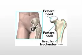 触摸你的每一块肌肉-骨盆的骨性结构2（坐骨结节和股骨大转子）