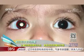 生活圈：女童拍照眼睛现白点，竟是恶性肿瘤在作怪，咋回事？看下视频封面