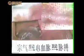中医脉诊——脉搏的产生靠的是什么原理视频封面