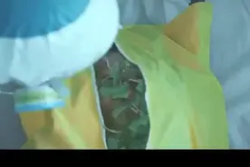 女孩不小心弄破手指，受伤部位竟长出嫩芽，不料最后全身长满了草视频封面