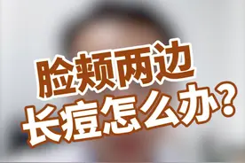 脸颊两边长痘，痘痘又大又痛，多半是肝火，用它能搞定视频封面