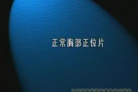 正常胸部正位片视频封面