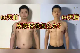 大体重瘦下来皮肤都会松弛，什么原因造成的，能解决掉吗