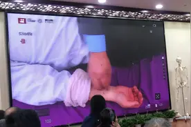 1月国医大讲堂 薛晏老师 实操醒脑开窍针刺法2视频封面