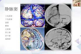 脑静脉系统血管解剖与造影解读视频封面