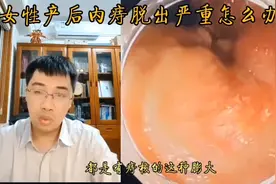 女性产后内痔脱出怎么办？内镜下内痔套扎治疗术了解一下！视频封面