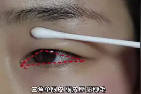 三角肿泡单眼皮 详细双眼皮贴法 一看就会 #双眼皮贴教程 #肿眼泡