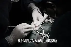 主人决定手术切除病变部分。决定切除病变的股骨头。 #狗视频封面