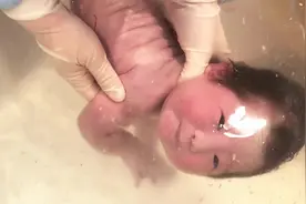郑州万安医院水下分娩，感受生命诞育的奇迹❤️#水下分娩视频封面