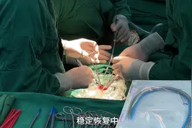 诸城市人民医院在全身麻醉体外循环下独立完成了潍坊地区首例胸…视频封面