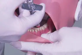 #科普#麻醉#拔牙#手术#牙科医生如何打麻醉药？