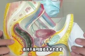 前列腺术后尿失禁，需要一直佩戴尿不湿吗？#健康科普 #医学科普视频封面