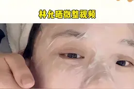 #林允晒微整视频！额头针孔渗出血珠，女人为了美，真是啥都敢啊#娱乐评论大赏 视频封面