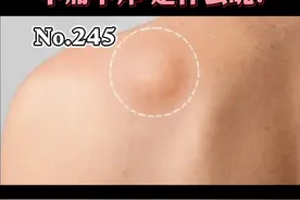皮肤上长肉球突起，不痛不痒，是怎么回事？#皮肤 #涨知识 视频封面