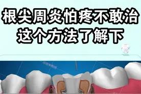 牙齿根尖周炎反反复复，不要再因为害怕疼痛犹豫了，看下这个办法吧！#郑州 #dou出新知 #知识合伙人