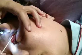 洗眼睛是用999纯银针，它能杀死眼睛里面104种细菌，像眼睛干涩视频封面