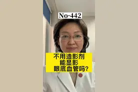 眼底检查系列3：OCT-A #北大医院眼科李骏医生 #实用眼科知识 #健康科普 #涨知识 #健康