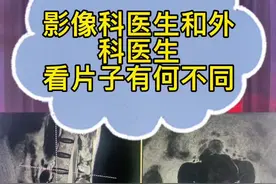 #影像科医生和外科医生看片子有何不同 #外科外科医生不愿意看报告视频封面