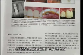 #科普 #科普一下 #牙齿 牙齿与大脑的关系视频封面