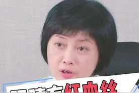 有没有什么方法可以把眼睛里的红血丝彻底消除呢？听听眼科医生怎么说！ #护眼 #健康科普 #医学科普 #健康 视频封面