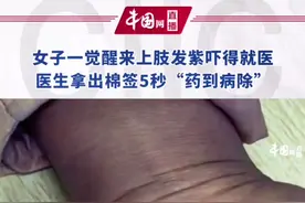 2月8日，辽宁阜新。女子一觉醒来上肢发紫吓得就医，医生拿出棉签5秒“药到病除”。