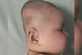 #老一辈对平头的执念 为什么他们非要给孩子睡成扁头？