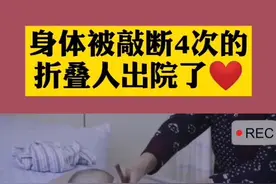 身体被敲断4次的折叠人出院了心#折叠人生 #泪目了 @抖音短视频视频封面