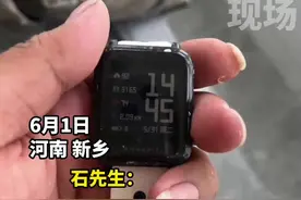 男子戴电子手表，手腕被电灼伤？客服：这种情况很少  #电子手表 #华米科技  #电击 视频封面