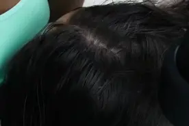 #asmr助眠视频 #头皮护理 #放松解压 黑白夫妇头皮屑清理极度解压