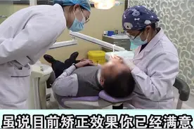 牙套能否提前摘，一定要参考医生的建议，因为你看到的效果和医生看到的不一定相同哦！#dou出新知 #郑州