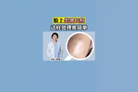 #夏天 热起来了，脸上就特别容易出油，长#痘痘 ，两支药膏帮你搞定。#科普#痘印视频封面