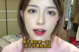 吼吼吼你们问的超多的关于牙套的问题都在这里啦！#什什怎么又是你