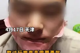 看着都疼啊😬#蜜蜡#刮胡子#搞笑 1视频封面
