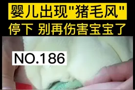 这个#育儿 #谣言 ，坑了多少#孩子 ，你听过#猪毛风 吗？转发扩散，不要再伤害宝宝了！#宝妈视频封面