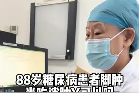 #糖尿病患者脚肿了，走不了路，光吃消肿药可以吗？#靠谱的健康知识又增加了 视频封面