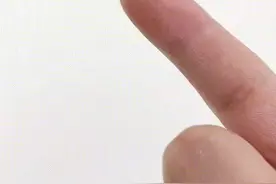 和 @朵朵生活馆 一起 #合拍 手指不小心扎进刺，不要慌，教你一招#生活窍门 #妙招 #好物推荐 视频封面