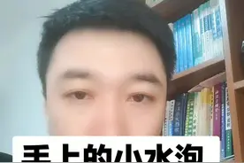 汗疱疹可以试试这个药，希望可以帮助到您！关注我，让您省钱又健康！视频封面
