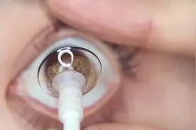 新手如何快速佩戴隐形眼镜赶紧来学会这几招👏