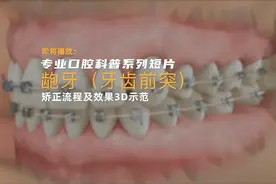 “龅牙（牙齿前突）矫正流程及效果3D示范”视频，视频封面