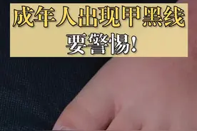 小孩子出现#甲黑线 不用太担心，成年人一定要警惕！#指甲视频封面