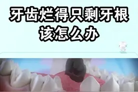 牙齿烂得只剩下牙根了，又不想拔牙，该怎么办呢？#dou出新知 #郑州