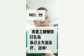 农民工在工地脚被锈钉子扎伤 ，用土方法治疗破伤风。今天教大家一招预防破伤风。#医学科 #热门话题#李医生