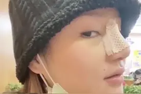 准备整鼻的姐妹，踩这些坑就是自己害自己啊！都我🩸泪总结下来的避雷指南！看完记得保存，可能会。。。。。