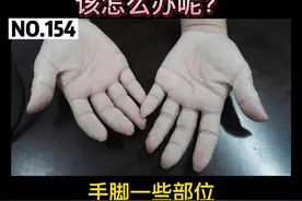手泡水后出现褶皱发白，这极有可能是水源性肢端角化症#涨知识#泡水 #发白 视频封面